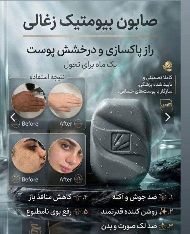 صابون کربن فعال بیز BIZ بیوممتیک ضدبو و ضد تعریق