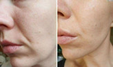 تونر ویتابلا VITA BELLA بیوممتیک تخصصی روشن کننده
