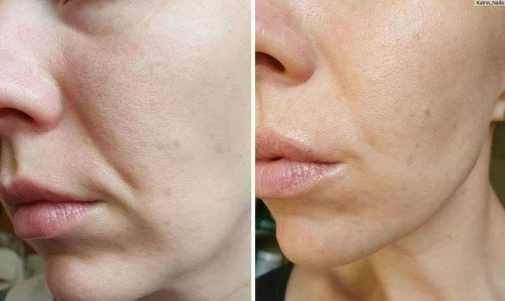 تونر ویتابلا VITA BELLA بیوممتیک تخصصی روشن کننده