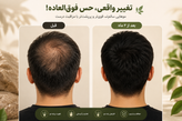 پک تقویت، ترمیم و آبرسانی مو | شامپو مورینگا اگزونیک + کرم موی آرگان بیز