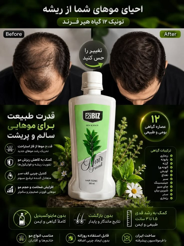 🌿✨ تونیک تقویتکننده و ضد ریزش مو هیر فرند BIZ | مراقبت تخصصی از موهای ضعیف و کمپشت ✨🌿