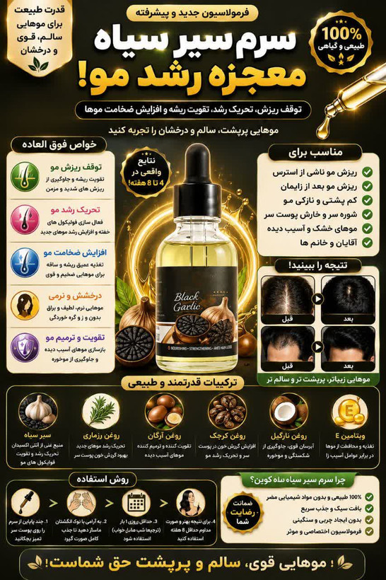 سرم سیر سیاه لاکچری کوین | سرم تقویتکننده مو، ریش و سبیل