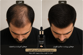 سرم سیر سیاه لاکچری کوین | سرم تقویتکننده مو، ریش و سبیل
