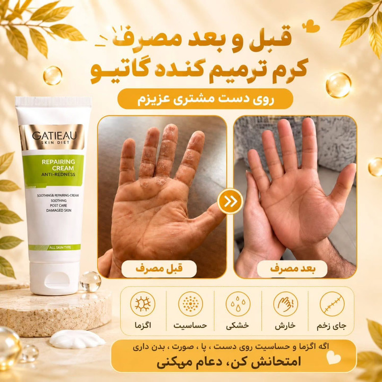 بیوممتیک 👉 کرم ترمیمکننده گاتیو GATIEAU | تقویت سد دفاعی و بازسازی پوست