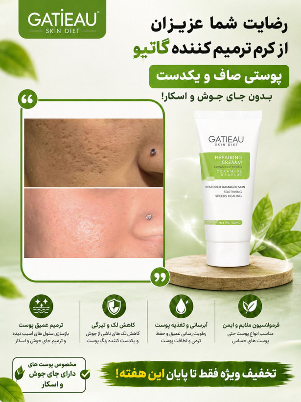 بیوممتیک 👉 کرم ترمیمکننده گاتیو GATIEAU | تقویت سد دفاعی و بازسازی پوست