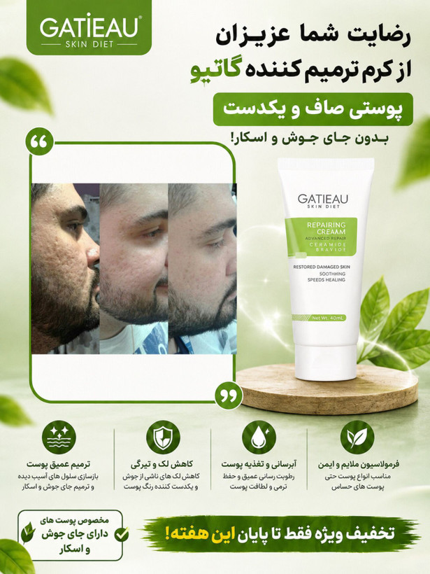 بیوممتیک 👉 کرم ترمیمکننده گاتیو GATIEAU | تقویت سد دفاعی و بازسازی پوست