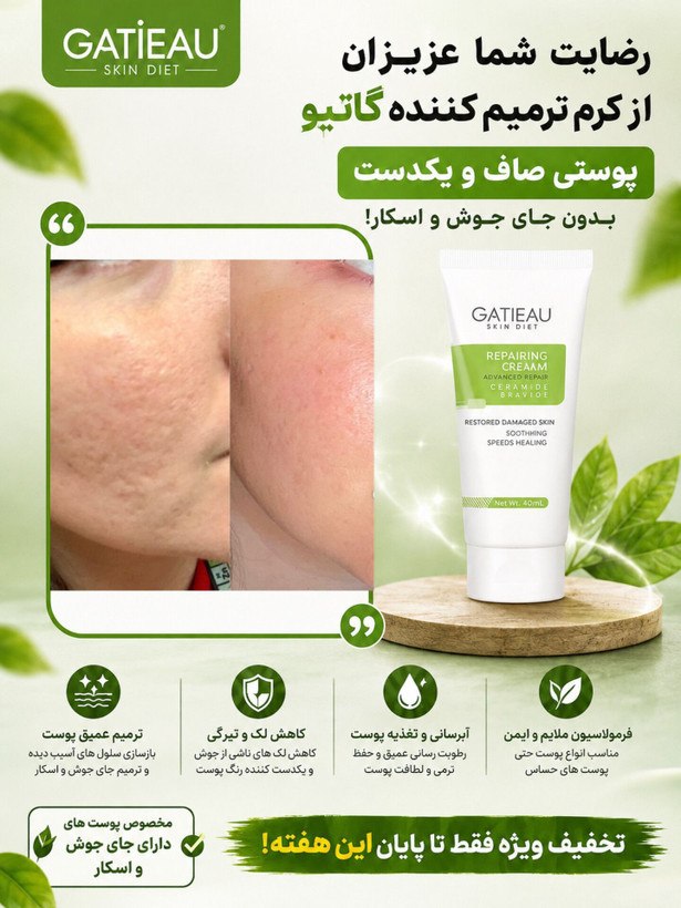 بیوممتیک 👉 کرم ترمیمکننده گاتیو GATIEAU | تقویت سد دفاعی و بازسازی پوست