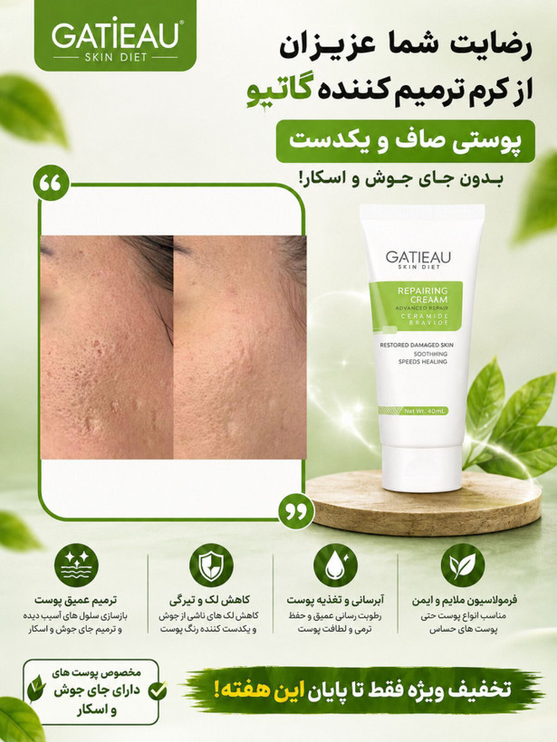 بیوممتیک 👉 کرم ترمیمکننده گاتیو GATIEAU | تقویت سد دفاعی و بازسازی پوست