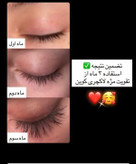 💎 سرم تقویت و بلند کننده مژه لاکچری کوین | اصل فرانسه ✨
