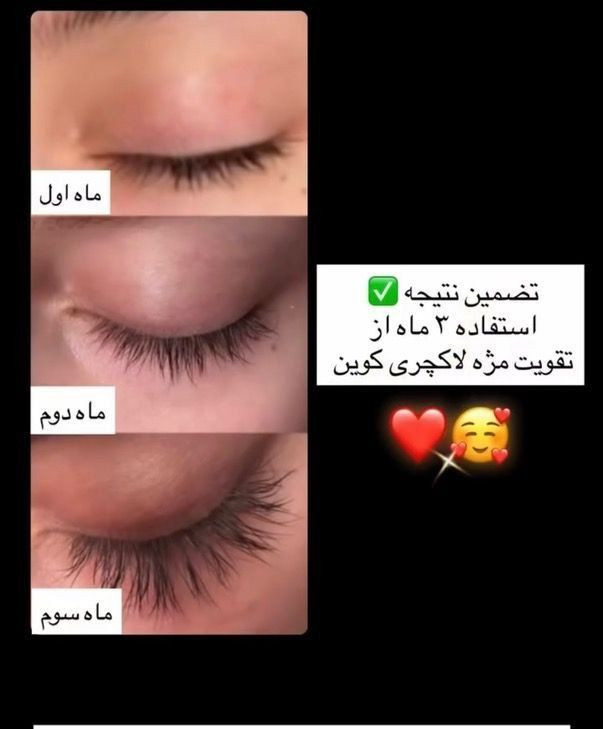 💎 سرم تقویت و بلند کننده مژه لاکچری کوین | اصل فرانسه ✨