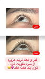 💎 سرم تقویت و بلند کننده مژه لاکچری کوین | اصل فرانسه ✨