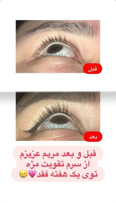 💎 سرم تقویت و بلند کننده مژه لاکچری کوین | اصل فرانسه ✨