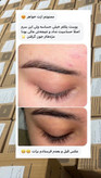 💎 سرم تقویت و بلند کننده مژه لاکچری کوین | اصل فرانسه ✨