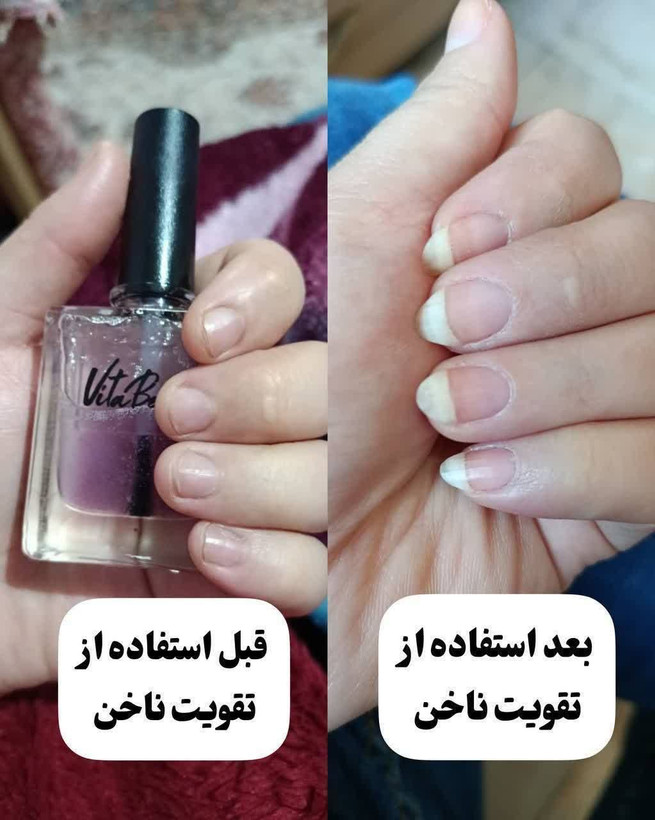 💅 سرم دوفاز عطری تقویتکننده ناخن و کوتیکول ویتابلا | آبرسان و ترمیمکننده