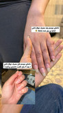 💅 سرم دوفاز عطری تقویتکننده ناخن و کوتیکول ویتابلا | آبرسان و ترمیمکننده