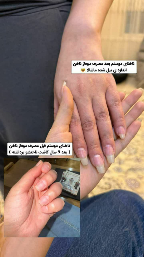 💅 سرم دوفاز عطری تقویتکننده ناخن و کوتیکول ویتابلا | آبرسان و ترمیمکننده