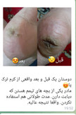 🔥 کرم پا ویتابلا؛ خداحافظی با خشکی و زبری و ترک پا! 👣