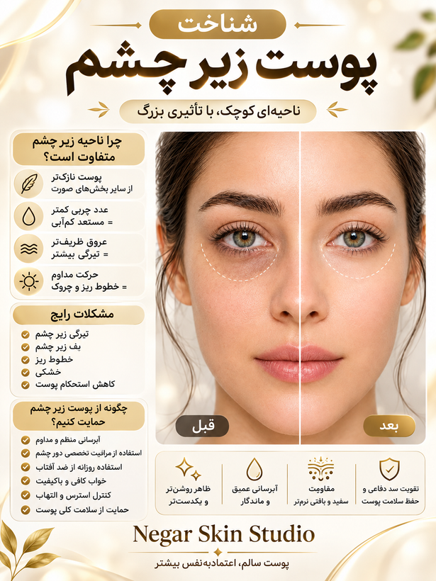 کرم دور چشم لاکچری کوین ضد چروک و آبرسان حاوی CBD و ویتامین E