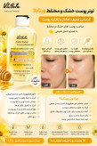 تونر پوست چرب و مختلط ویتابلا | کنترل چربی و آبرسان