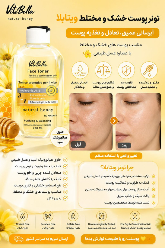 تونر پوست چرب و مختلط ویتابلا | کنترل چربی و آبرسان
