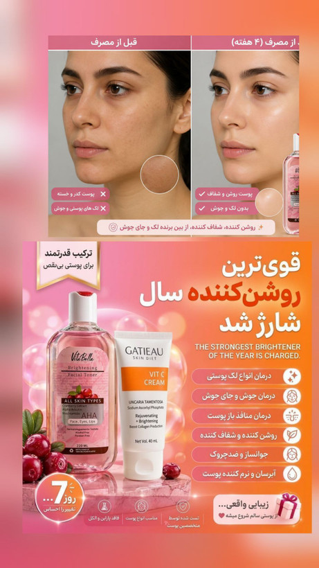 تونر روشن کننده ویتابلا | حاوی AHA، نیاسینامید و آلفا آربوتین